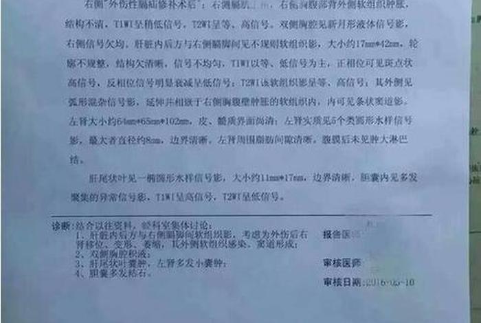 佛学肾萎缩的因果（肾萎缩的征兆）