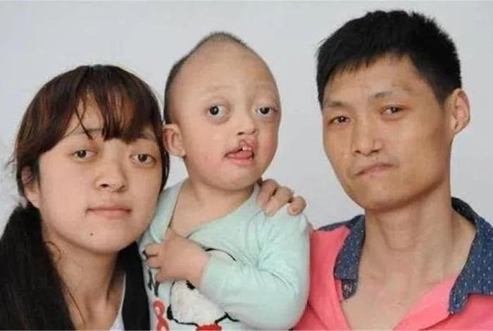 先天有缺陷的人命运；先天有缺陷的人命运怎么样