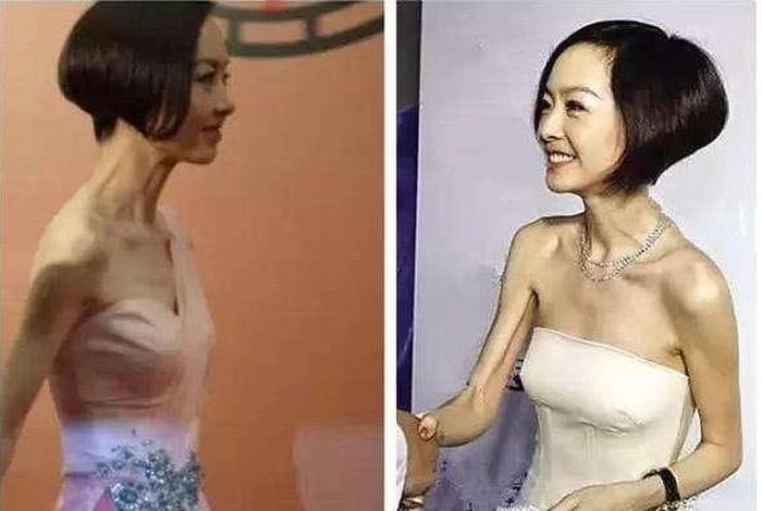 瘦骨原理，瘦骨产品是真的吗