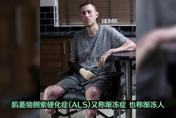 渐冻人是什么意思啊；渐冻人症是什么症状