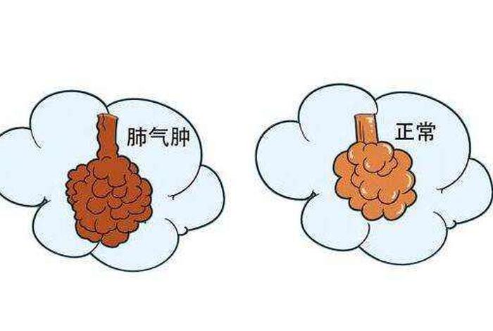 痰多的原因有哪些、痰多的主要原因是什么