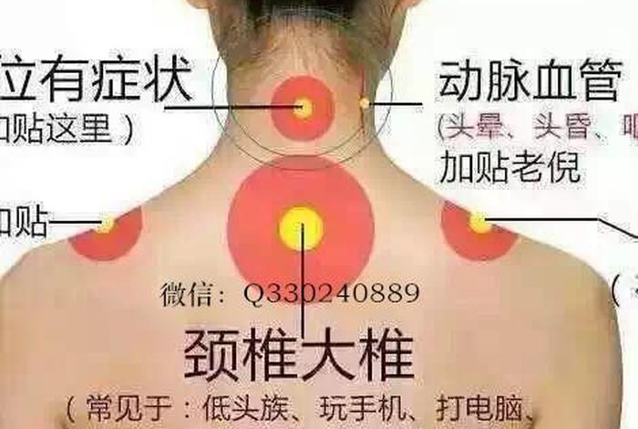 佛教怎么看待脊椎问题、佛说颈椎病是什么因果