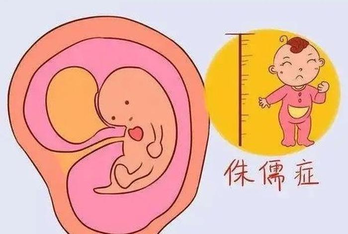 佛教对胎儿的阐述，佛教怎么看待胎儿畸形