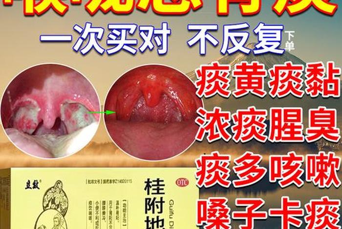 痰多是因为啥 痰多是因为啥导致的
