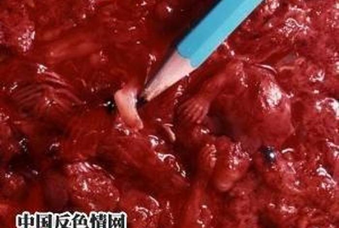 佛教40天之内打胎、佛家打胎