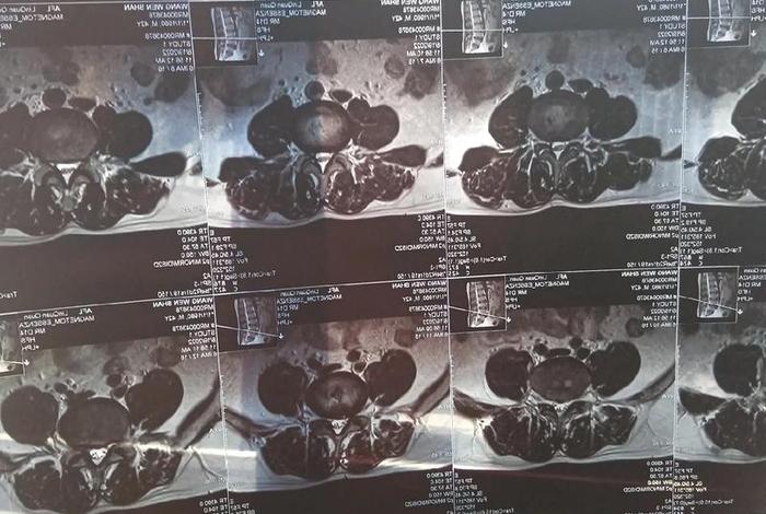 佛法谈腿疼的果报（佛教腿疼病的咒语）
