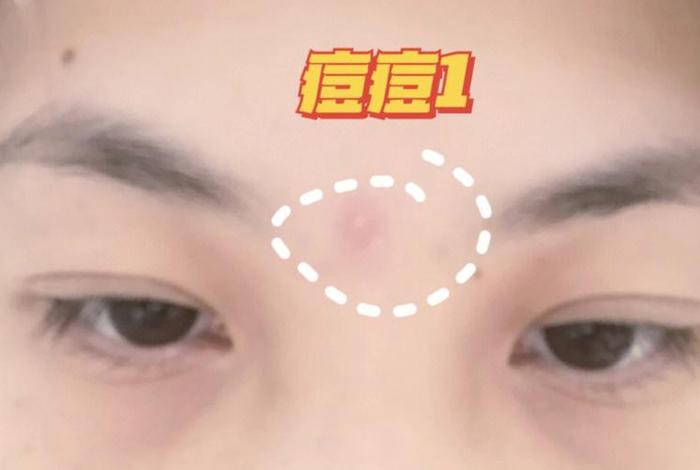 眉心发麻佛教、眉心发麻是什么征兆
