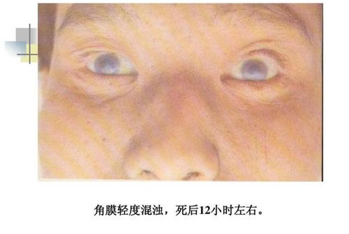 人临终的状态、人临终状态眼睛会不会发光发亮