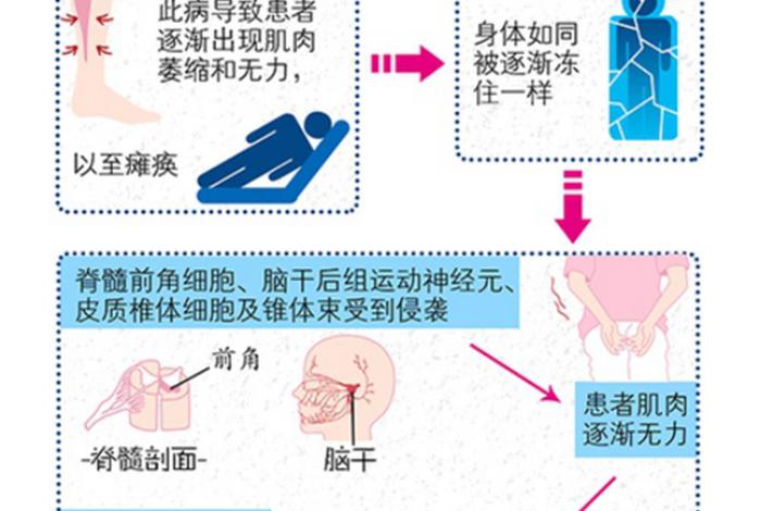 渐冻症 因果 - 渐冻症诱因