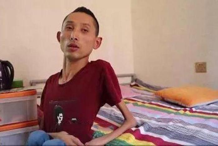 渐冻症佛教，渐冻症是什么业障