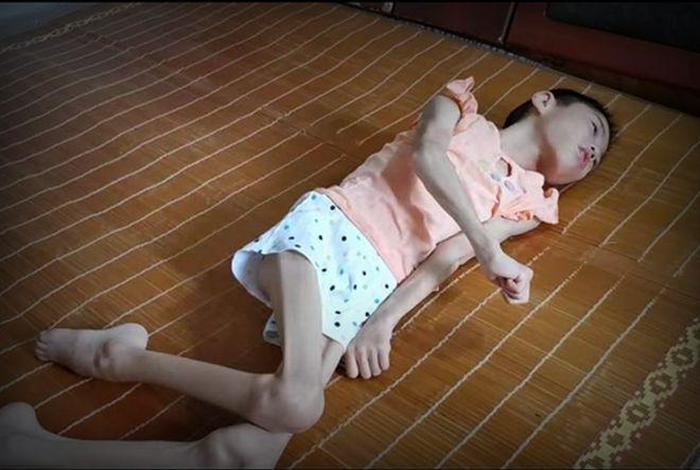 瘦骨头是什么意思 瘦骨主页
