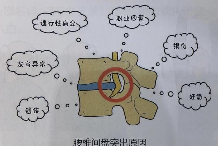 佛教腰椎间盘突出是什么果报、佛教讲腰椎间盘突出的因