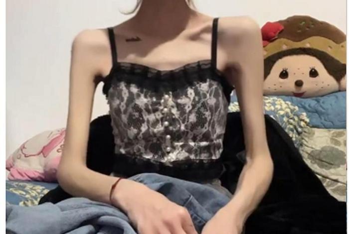 瘦骨如什么（瘦骨的样子）