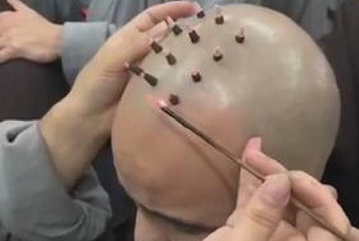 佛教中的戒 - 佛教中的戒疤
