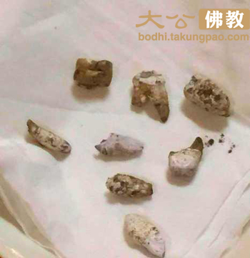 「佛教」觉真长老法体荼毗圆满并现稀有心脑舍利 「佛教」觉真长老法体荼毗圆满并现稀有心脑舍利